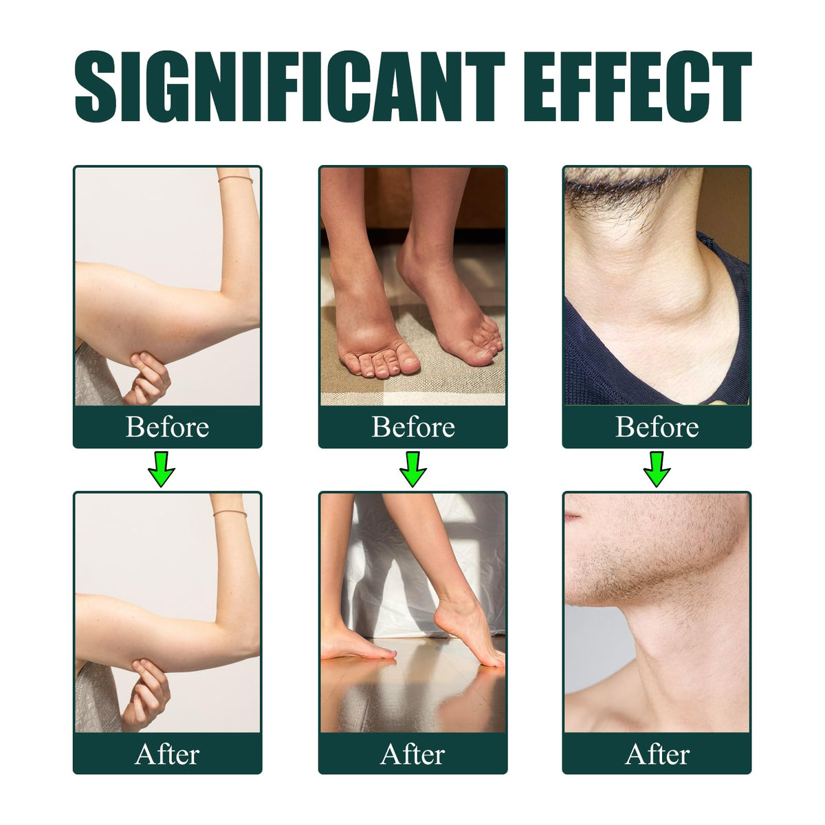 Slifthistle Lymphatic Drainage Drops, Lymphatic Support Liquid Drops, with Herbal Ingedients, Reduce Bloating, Full Body Detox & Cleanse, Promote Circulation, Vegan, Non-GMO (60ml) (1) Slifthistle buy supplements Au