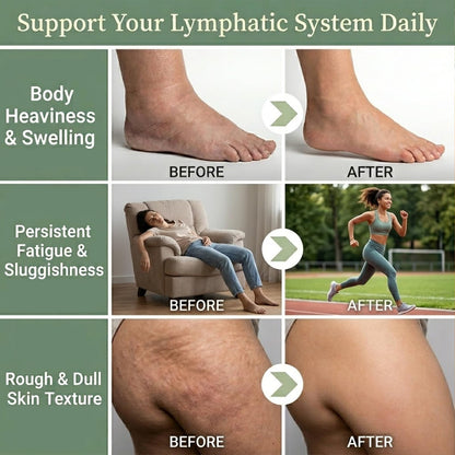 Lymphatic Drainage Capsules - Ease Body Heaviness & Facial Puffiness - Supports Natural Fluid Balance & Metabolism、Joint Discomfort - with Echinacea & Dandelion - 90 Vegan Capsules & Non-GMO Jorvinl buy supplements Au