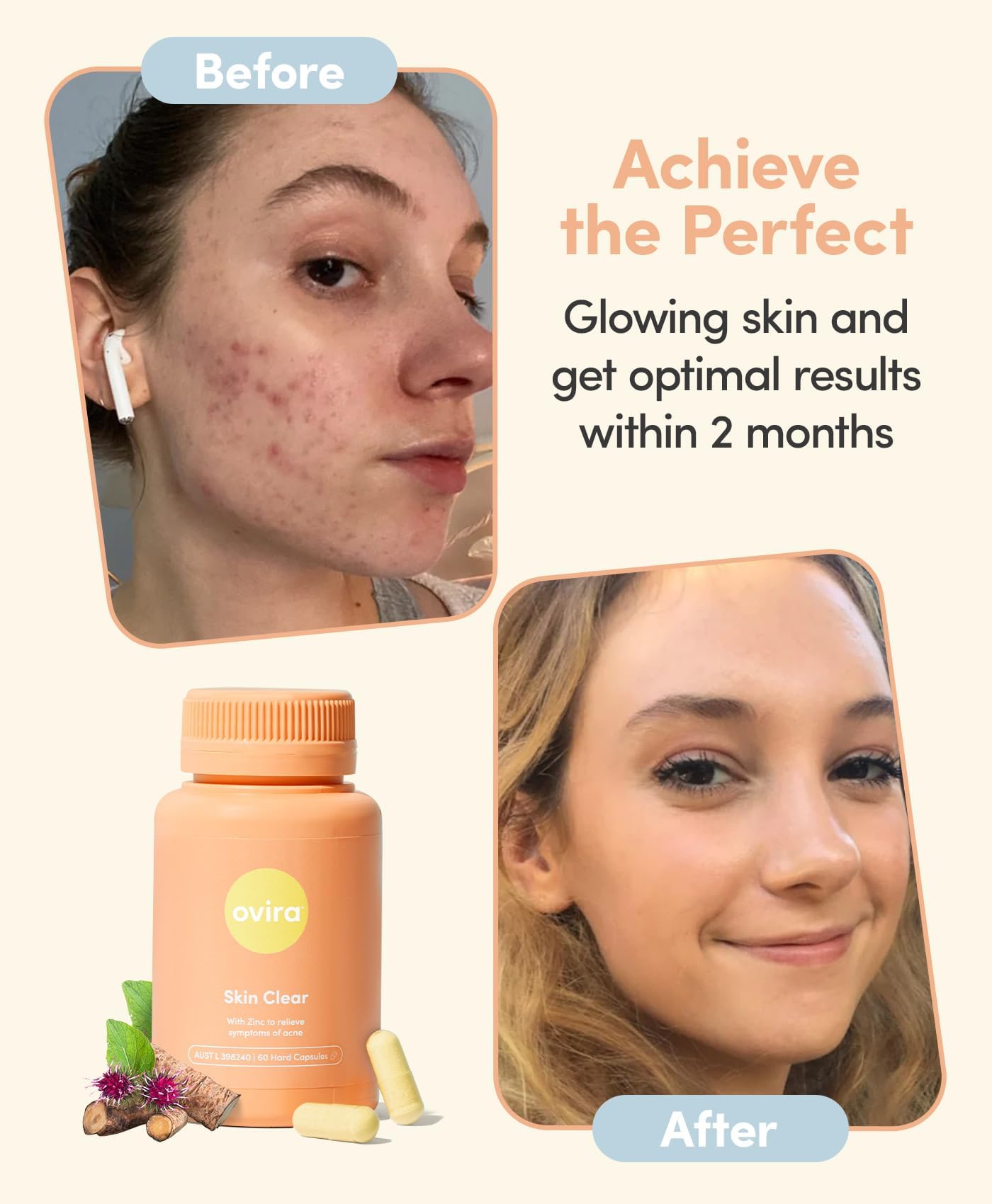 Ovira Skin Clear with ZINCBRIGHT - 60 Capsules for Clear and Glowing Skin | Rosacea & Hormonal Acne Treatment | Support Collagen Production | Acne Supplements for Women & Men - Pack of 2 OviraBuy Supplements Australia