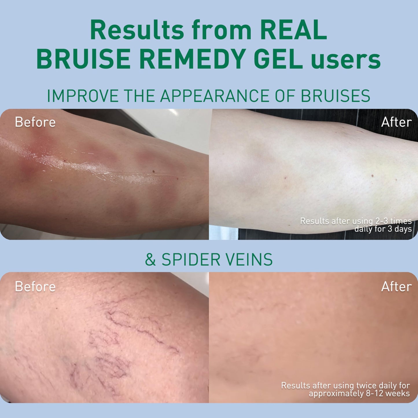 PROcure Arnica & MSM Bruise Remedy Gel – Paraben-Free, Unscented Arnica Montana Gel for Bruising, Spider Veins & Skin Discoloration – 2 Pack PROcureBuy Supplements Australia